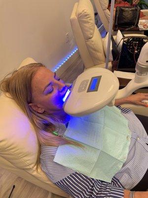 Teeth whitening available! In as little as 20 minutes you will see results 2-8 shades whiter with little to no sensitivity.