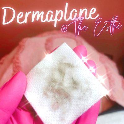 Dermaplaning removes dead skin and vellus hairs, revealing fresh and youthful skin