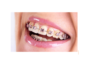 Jacksonville Orthodontics