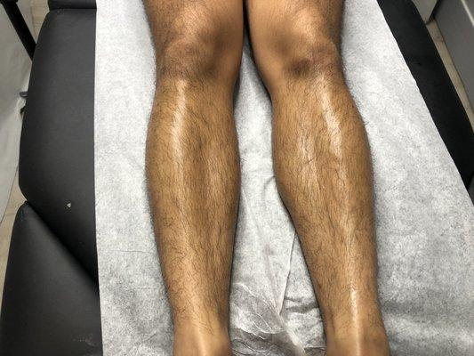 Legs before the wax