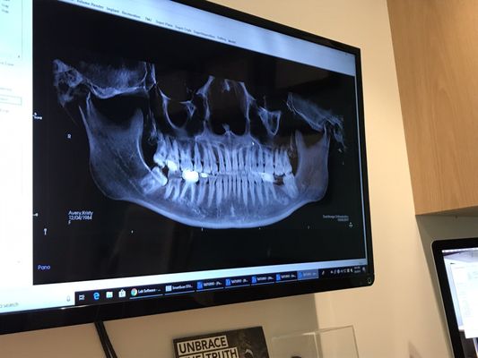 It's what's on the inside that counts. My x-ray