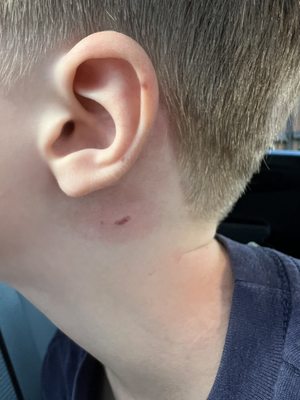 My 7-year old got stab by a pair of scissors while having his haircut by Marshall.