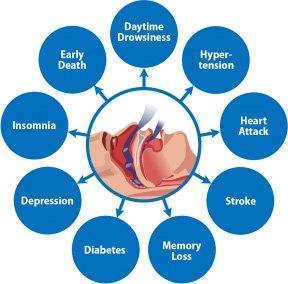 Dangers of Sleep Apnea