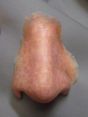 Nose prosthesis