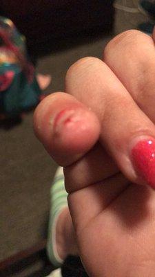 My pinky nail after I cut the fake nail down