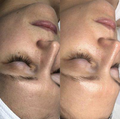 Customized facial