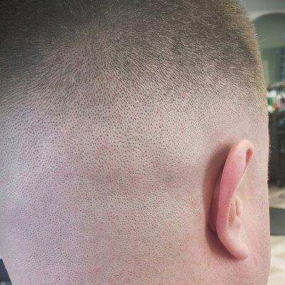 Skin Fade