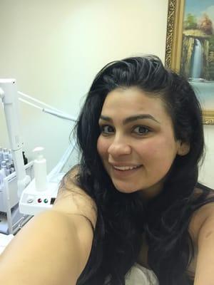 After my micro dermal facial!!! Skin so bright and feeling good!!!