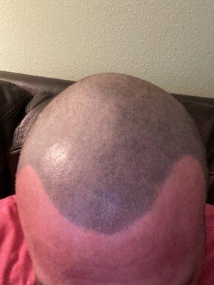 Pacific Northwest Scalp Micropigmentation