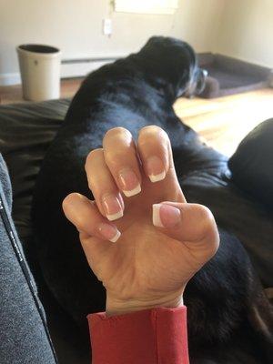 8 days post-manicure