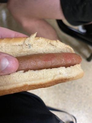 moldy hotdog bun