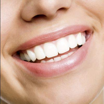 45 min teeth whitening session $60