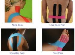 Kinesio Tape applications