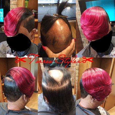 Tracks added hairloss