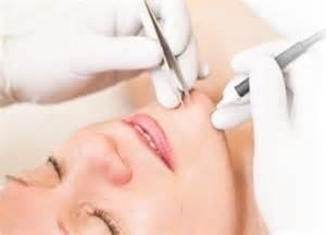 Electrolysis for permanent hair removal.