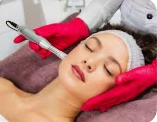 Microneedling