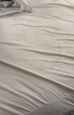 Stains on sheets