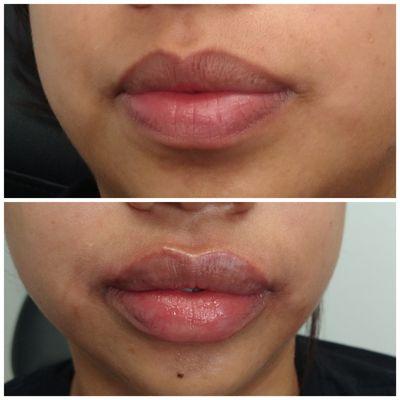 Lip enhancement
4784448651
By appointment only