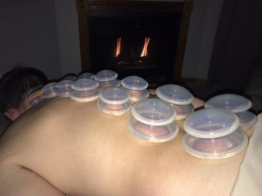 Massage cupping helps to bring blood flow to the surface of the skin and the muscles.