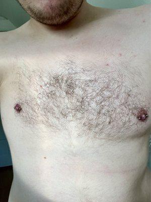 Pierced male nipples