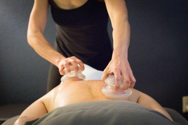 Cupping therapy available