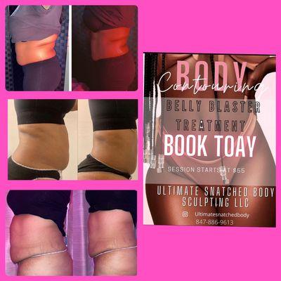 Ultimate Snatched Body Sculpting