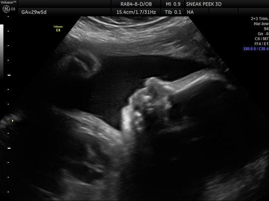 29 Week- 2D Profile