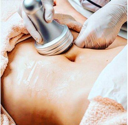 Lipocavitation treatment