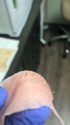 ROOTS - waxing taking hairs out right from the root!