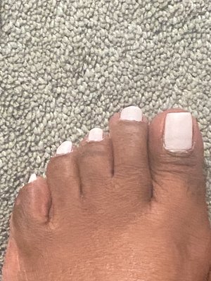 Pedicure