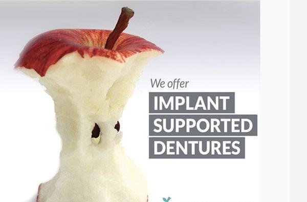 Implants