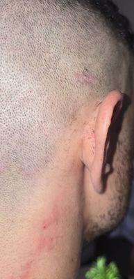 The cut above my ear is deeper than it looks, pics were taken after I cleaned up the cuts a bit.