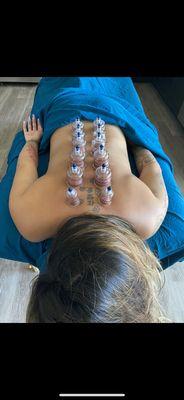 Cupping therapy