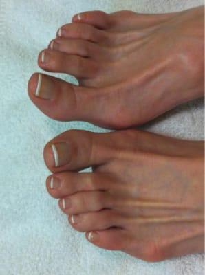 French polish - spa pedicure