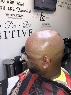 Hydro Bald Head Service with Razor line