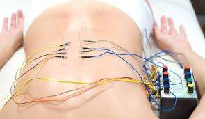 Electro-Stem can help enhance an acupuncture treatment