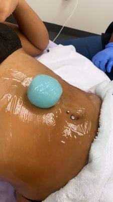 Ice treatment with cavitation