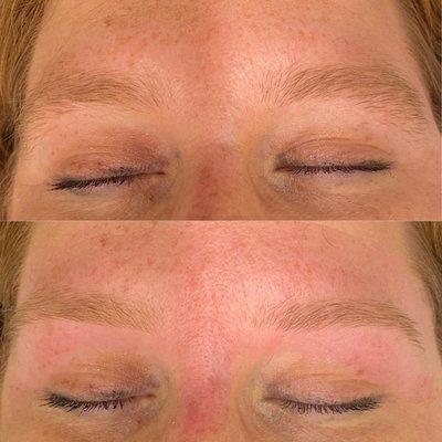 Sugar hair removal on brows before and after