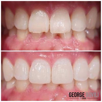 George Bovili, DDS