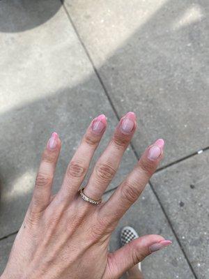 Ring finger repair compared to other nails