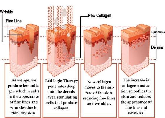 MyTime Red Light Therapy