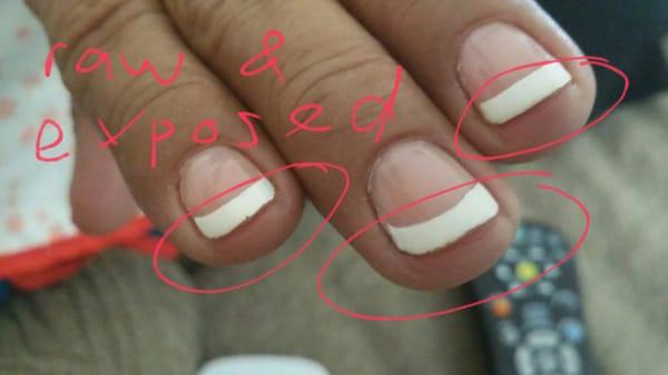 How is this okay? She cut the nail and surrounding area until it was pink and raw!