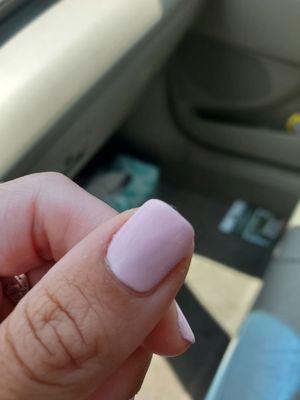 Uneven and streaky nail