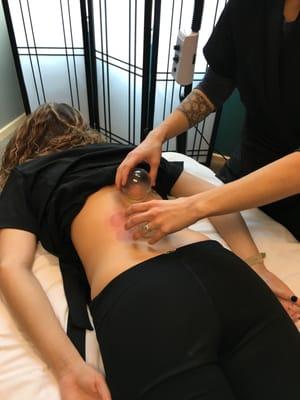 Danielle doing some cupping for Chelsea!