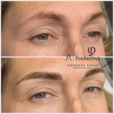 Eyebrow lift, aka microblading.