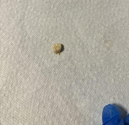 tooth that was found in taffy