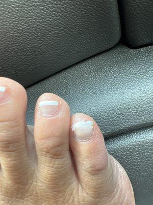 Pinky toe is painted white