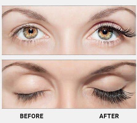 Lashes for days right here in Denver without hours in a chair! How about just seconds in the morning with Latisse! Now here at Andelana