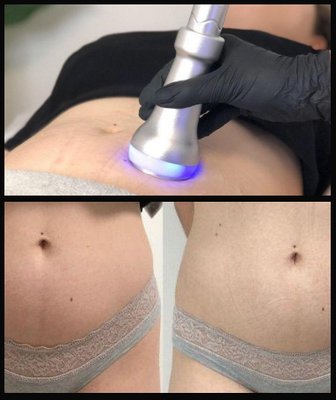 Fat Slimming, Body Toning, Cryo Facials, BEMER, LED Stem Cell Activation (all natural, non-invasive)