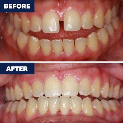 Call us to schedule a consultation! (310) 953-3661 https://www.dentistcarson.com/